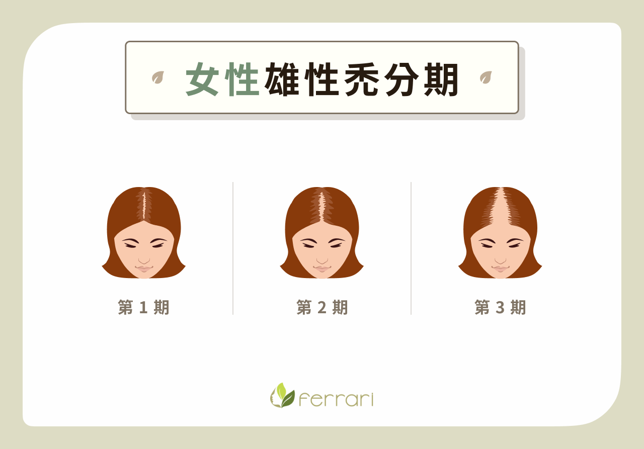 髮拉儷皮膚科診所-雄性禿女生
